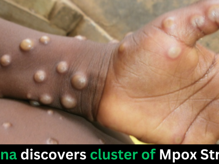 China discovers cluster of Mpox Strain