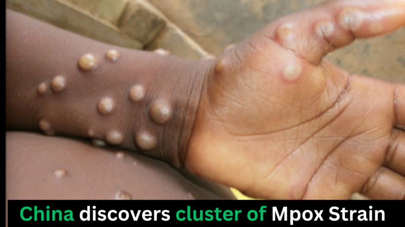 China discovers cluster of Mpox Strain